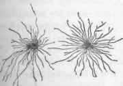 Actinomycosis. From urine. Filamentous form.