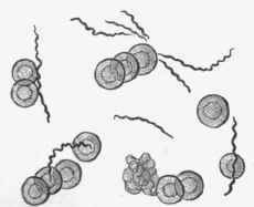 Blood from case of relapsing fever, showing corpuscles and spirillum Obermeieri.