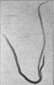 Doehmius duodenalis, male and female, x 3.
