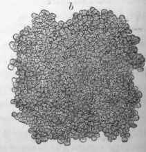 From gumma of liver, same section as Fig.