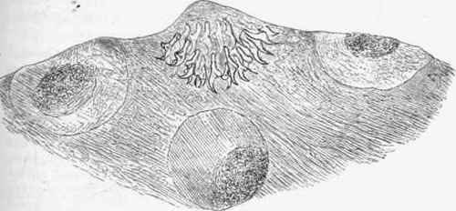 Head of cysticercus cellulose;e found in substance of brain, x 90.