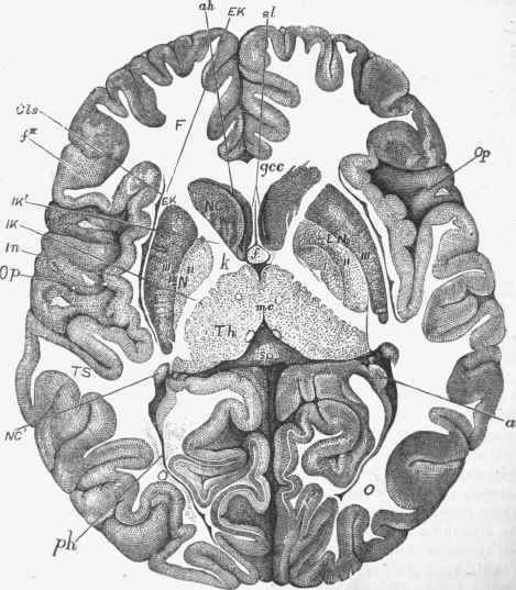 Horizontal section of brain of a child nine months old, the right side at a somewhat lower level than the left.