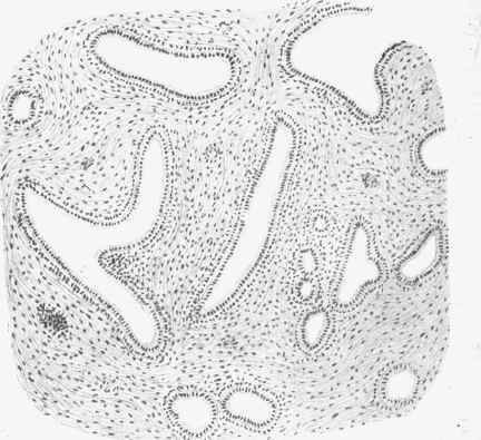 Mammary adenoma.