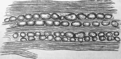 Muscle in pseudo hypertrophic paralysis.
