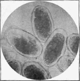 Ova of ascaris lumbricoides. x 280.
