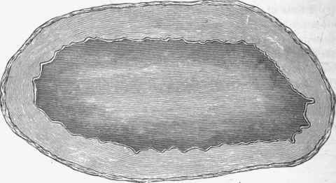 Transverse section of normal cerebral artery to contrast with Fig.