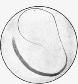 Trichocephalus dispar or whip shaped worm from the ceecum.