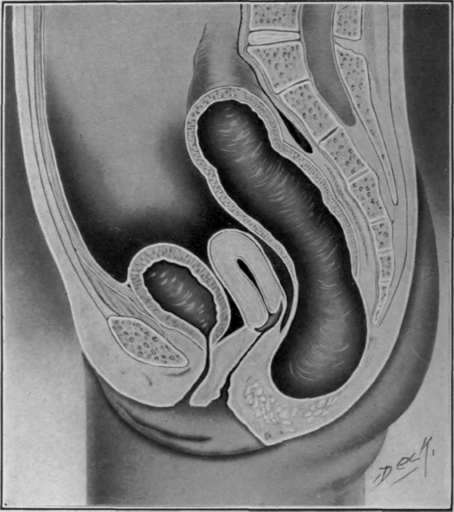 Fig. 13. Entire absence of the anus.