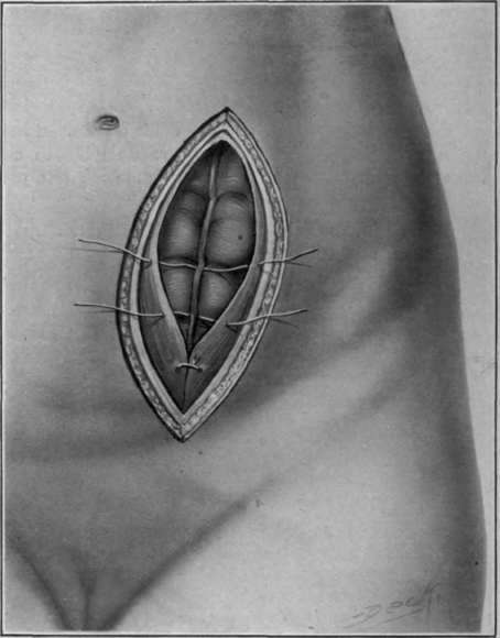 Fig. 34. Sigmoid