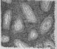 A Piece of Gastric Mucosa (patient M. G).