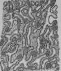 D Small Pieces Of Gastric Mucosa 31