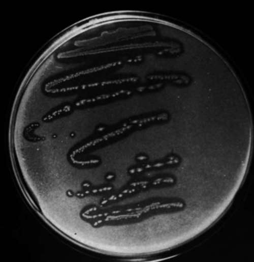 Colonics of Pseudomonas testosteroni