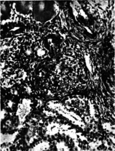 Kidney from a rat exposed to cold