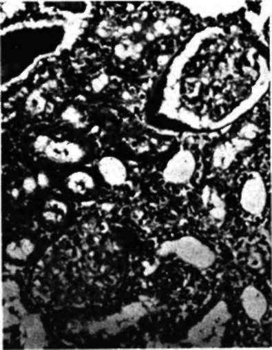 Kidney from a rat given sodium chloride diet by stomach tube for 84 days