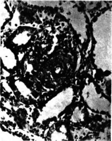 Kidney from an adrenalectomized rat treated with methylandrostenediol