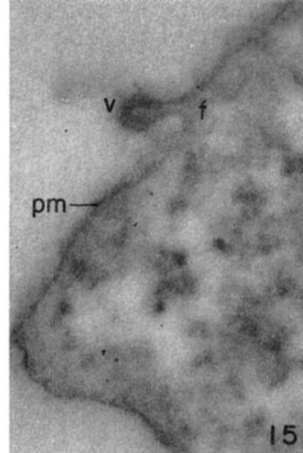 Edge of leukemia tumor cell showing virus panicle