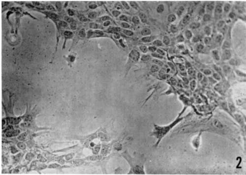 Expanding mouse mammary epithelium