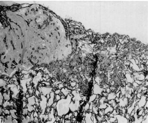 Gelatin sponge matrix culture of submandibular gland from 8 week old