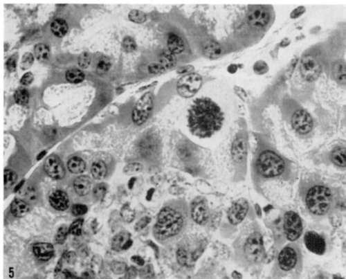 Giant mitotic figure