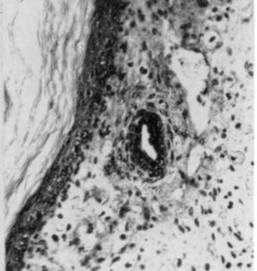 Hardy's technique of organ culture