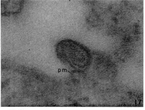 High magnificat ion of newly formed leukemia virus particle
