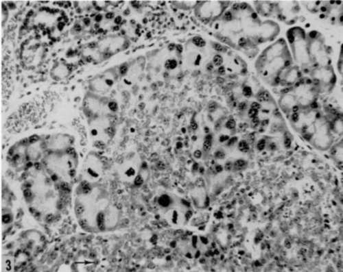 Lobule of extraorbital lacrimal gland