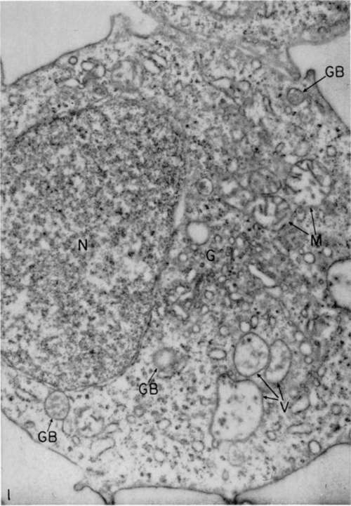 Myeloblast from circulating blood of diseased bird