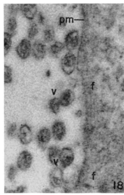 Note parallel arrays of fine filaments along edge of cell