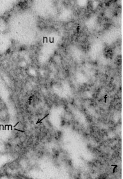Nucleoplasm close to nuclear membrane