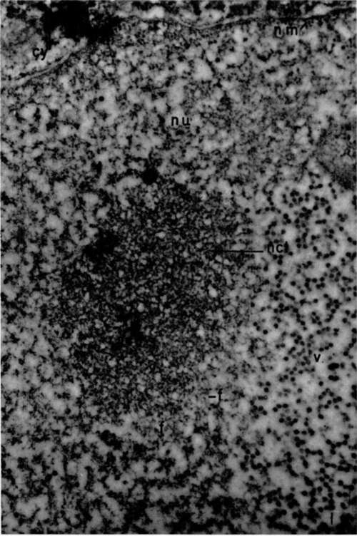Nucleus (nu) of polyoma tumor cell showing relation of nucleolus