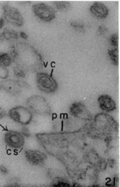 Viruses already detached from plasma membrane