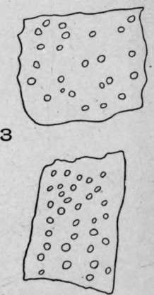 Pitted Vessels.