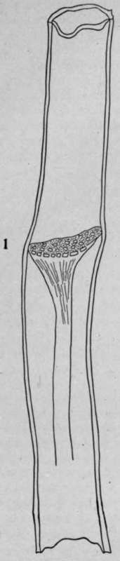 Sieve Tubes HistologyOfMedicinalPlants 122