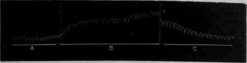 Cerebral Stimulants 104