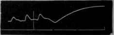Fig. 136.   Shows the effect of opium. In the first part of the tracing the intestine was supplied with apnoeic blood; in the latter with blood containing opium.