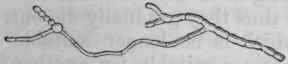 Fig. 16. Hyphomycetes, or Moulds