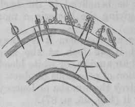 Fig. 18. A piece of the anterior part of the body of a Daphne, with a number of spores, some of which are still in the intestinal canal, others are penetrating the intestinal wall, and others are free in the abdominal cavity, where they are attacked by leucocytes.