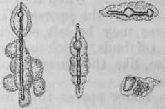Fig. 20. Different stages of the changes undergone by spores through the action of phagocytes