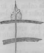 Fig. 21. A germinating spore with leucocyte adherent to it