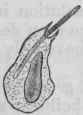 Fig. 27. Leucocyte of a frog from the neighbourhood of a piece of the lung of a mouse infected with anthrax about forty two hours after the piece of lung had been placed under the skin of the frog's back.