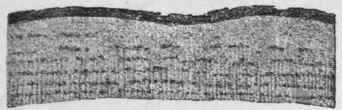 Fig. 125.   Alder Buckthorn bark. Transverse section. Magnified. (Berg.)