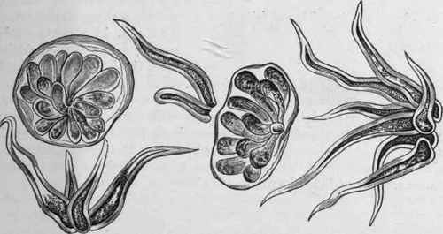 Fig. 229. Kamala, showing glands with their secreting cells and grouped hairs. Magnified. (Moeller.)