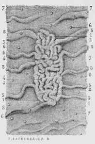 A Peyer's Patch