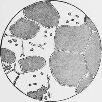 THE CELL WALLS RUPTURED.