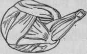 Muscles of shoulder.
