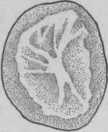 Potato. Transverse section. (After Cowden and Bussard).