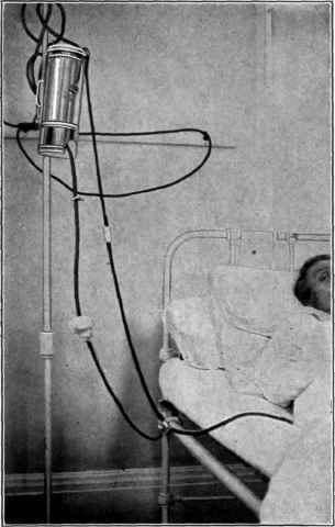 Patient is being given saline by the Murphy drip method into the bowel.
