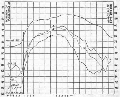 Composite curves for changes in pulse cycle duration with exertion, Squad A.