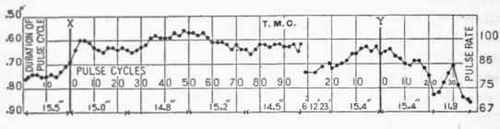 Transition Pulse Of A Group Of Normal Men 123