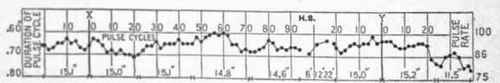 Transition puke curves for a group of five normal men.